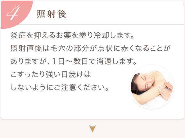 4.照射後